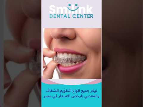 افضل اسعار التقويم في مصر #dentist #orthodontist #dentistry #teethwhitening #تجميل