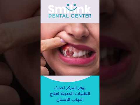 علاج التهاب الاسنان للحامل