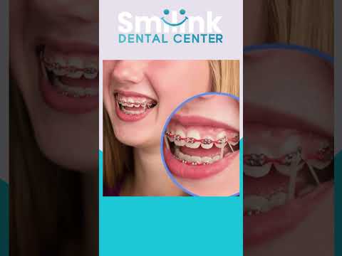 من افضل مراكز التقويم في مصر #dentist #teethwhitening #dentistry #تجميل