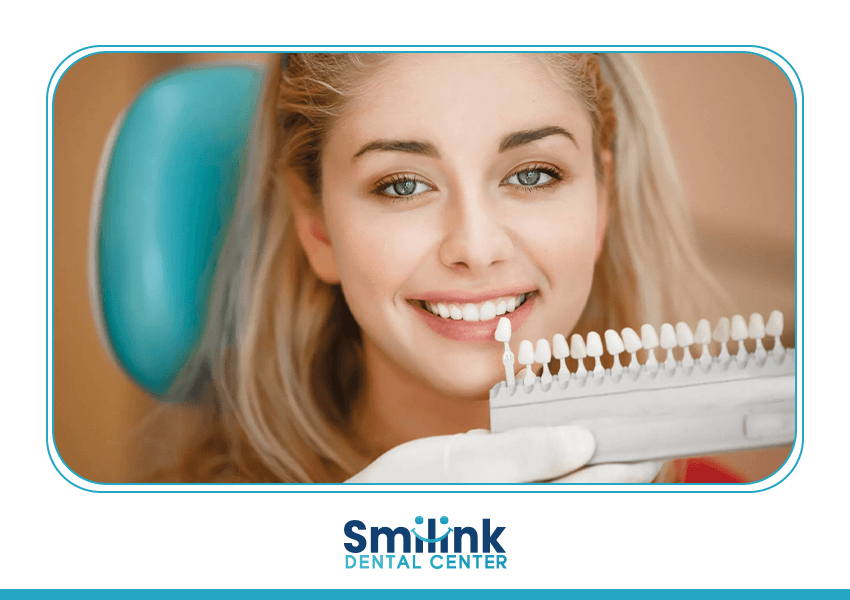 سمايل لينك | Teeth whitening
