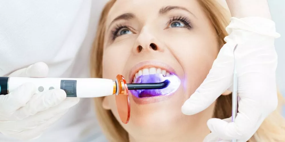 سمايل لينك | طرق تبييض الاسنان