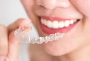 سمايل لينك | انواع تقويم الاسنان المعدني