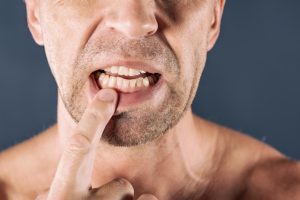 علاج التهابات اللثة والأسنان 4 علاج التهابات اللثة والأسنان