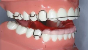 عيادات تقويم الاسنان