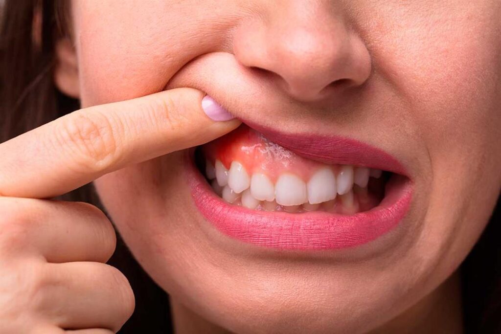 علاج عصب الأسنان بدون ألم علاج عصب الأسنان بدون ألم