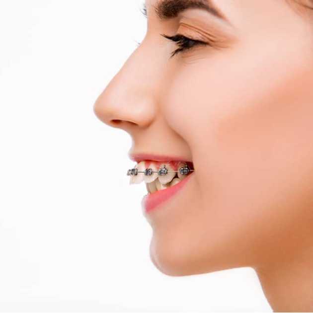 مراكز تقويم الاسنان