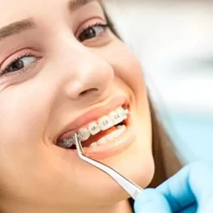 تقويم اسنان اطفال