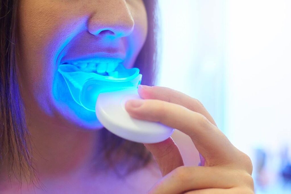 سمايل لينك | أفضل طريقة لتبييض الأسنان طبياً