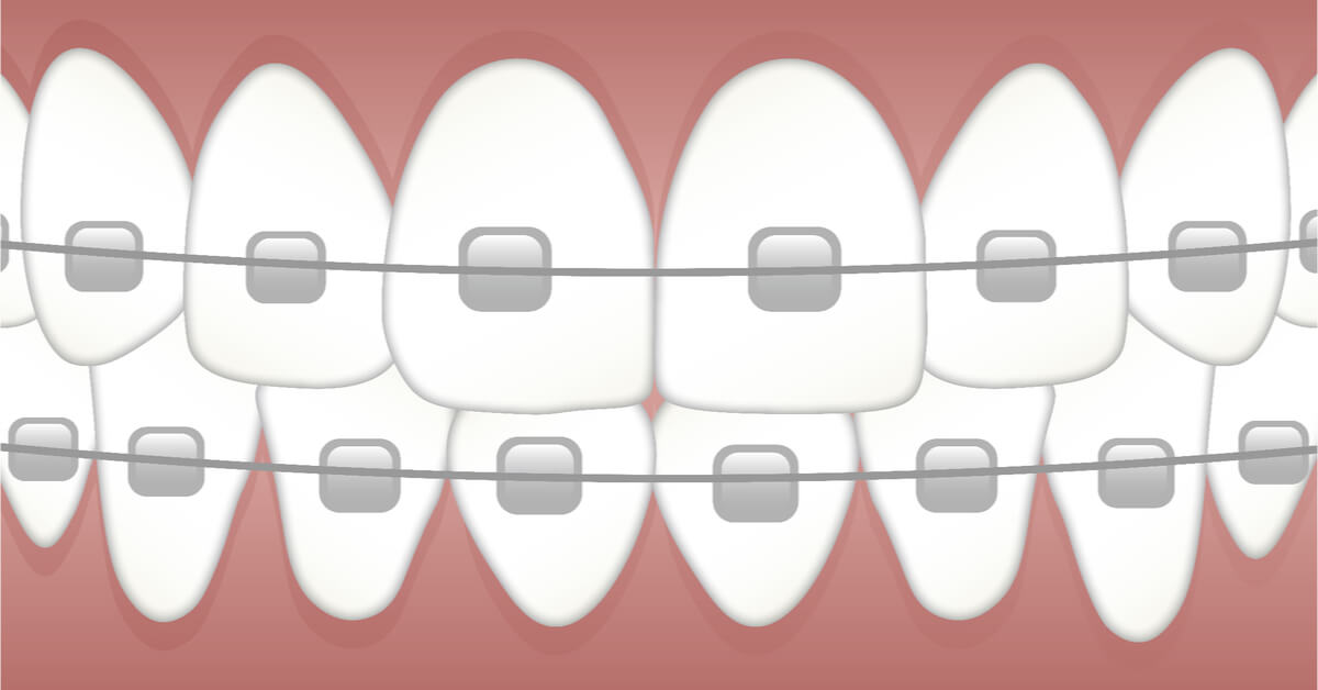 سمايل لينك | عيادة تقويم اسنان