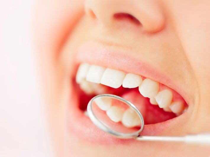تجميل الاسنان بالحشوات تجميل الاسنان بالحشوات