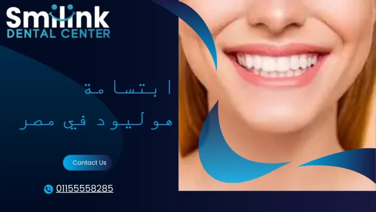 ابتسامة هوليود في مصر