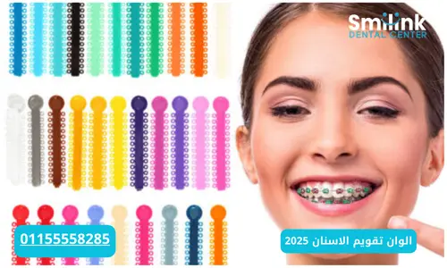 سمايل لينك | الوان تقويم الاسنان 2025