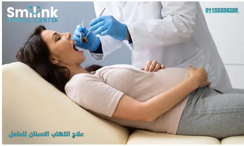 سمايل لينك | علاج التهاب الاسنان للحامل