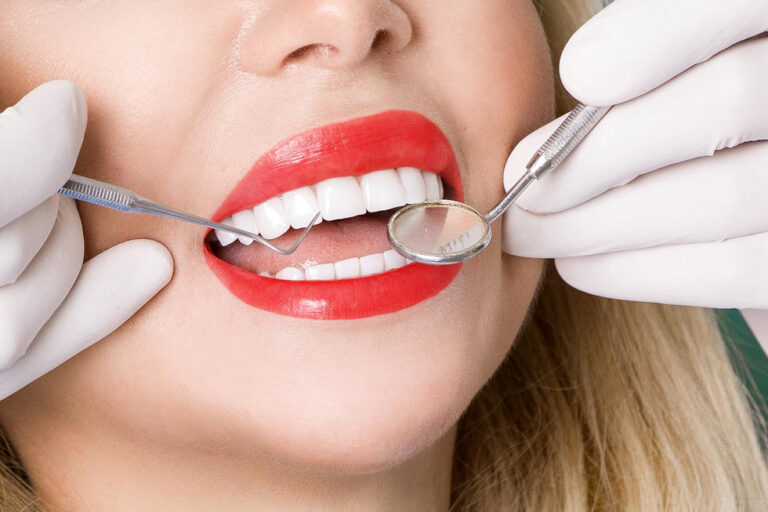 صور قبل وبعد تجميل الأسنان