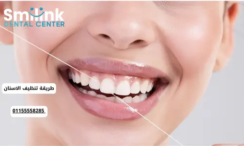 سمايل لينك | طريقة تنظيف الاسنان