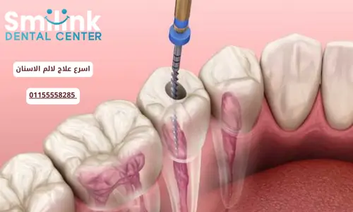 اسرع علاج لالم الاسنان