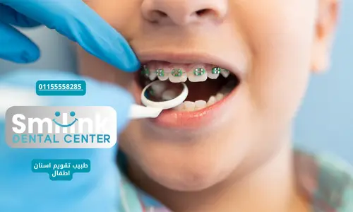 طبيب تقويم اسنان اطفال