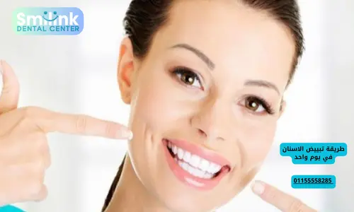 سمايل لينك | طريقة تبييض الاسنان في يوم واحد