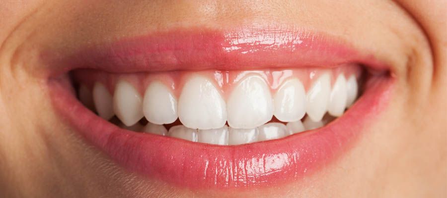 افضل عيادة تجميل اسنان في المحلة