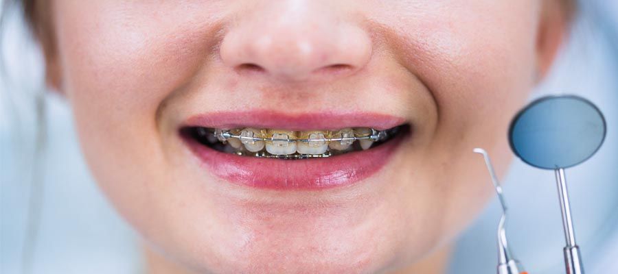 افضل عيادة تقويم الأسنان