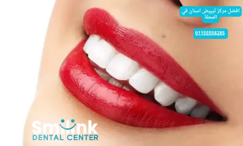 افضل مركز تبييض اسنان في المحلة