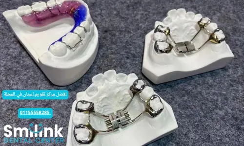 سمايل لينك | افضل مركز تقويم اسنان في المحلة