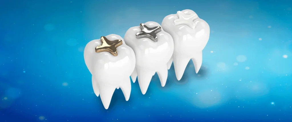 عيادات تجميل الاسنان عيادات تجميل الاسنان