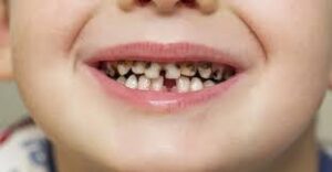 خدمات طب الأسنان للأطفال