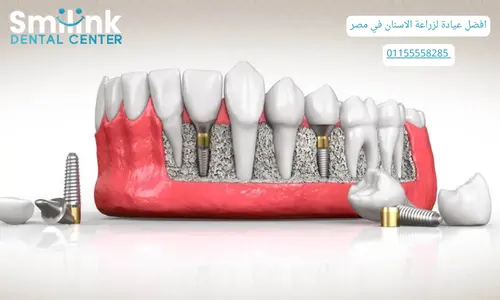 سمايل لينك|Posts 2025