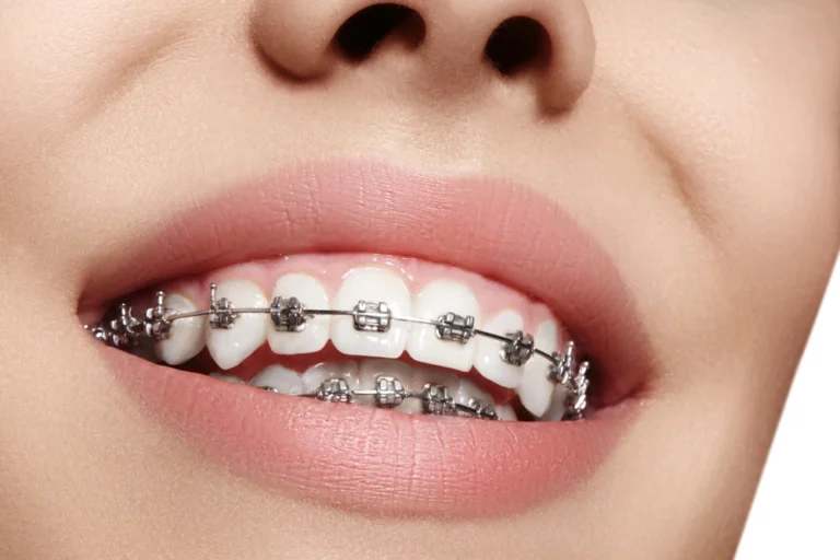 أفضل مركز تقويم أسنان 2026