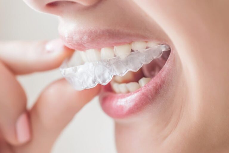 التقويم المتحرك: إمتى يكون اختيار مناسب؟