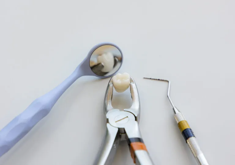 خطوات ونصائح قبل وبعد قلع الأسنان