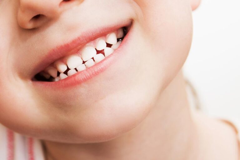 علاجات تجميل الأسنان للأطفال والمراهقين
