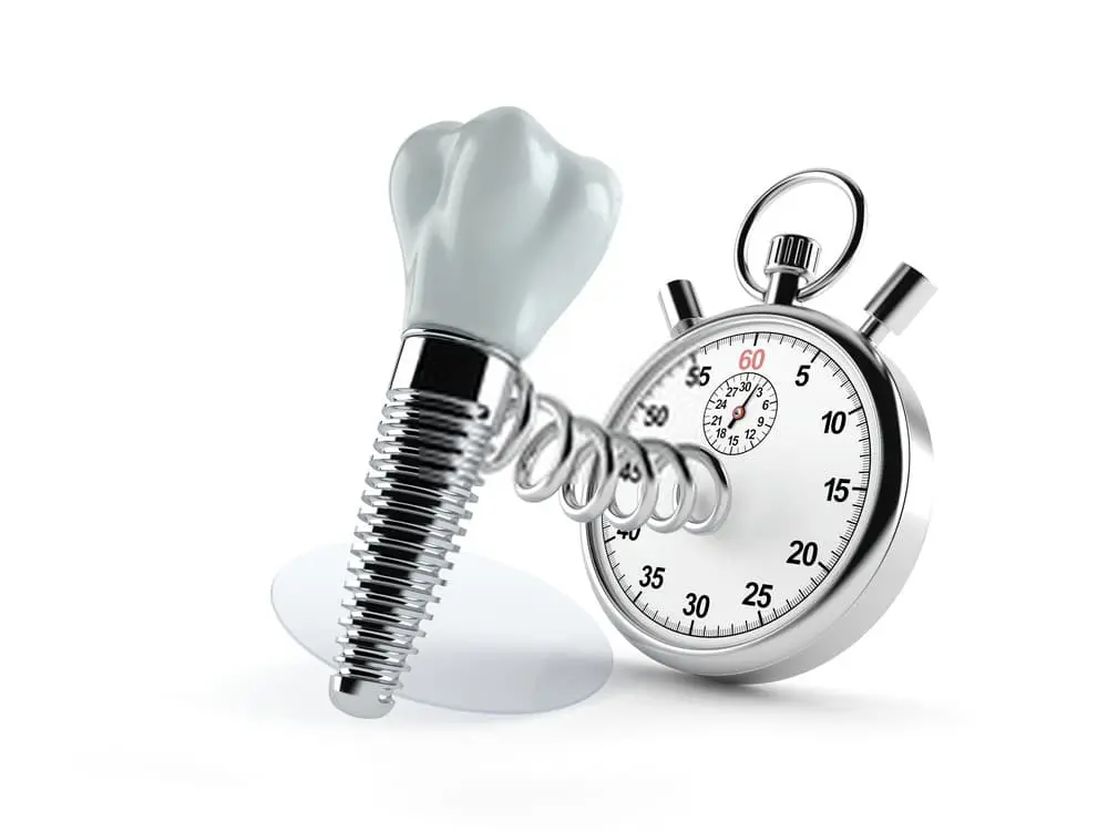 خطوات زراعة الأسنان في مركز سمايلينك