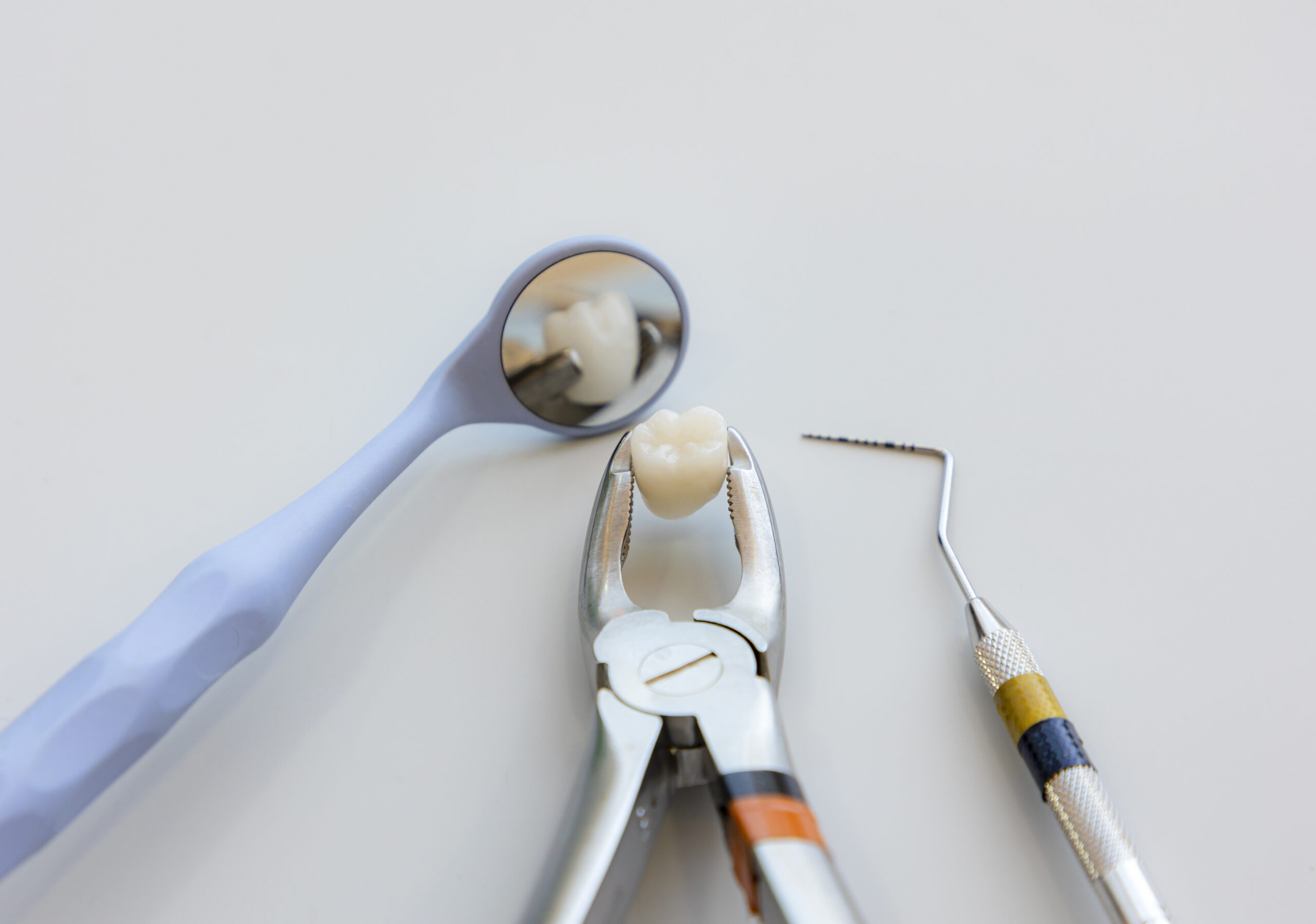 سمايل لينك | خلع الأسنان الجراحي سمايل لينك | خلع الأسنان الجراحي