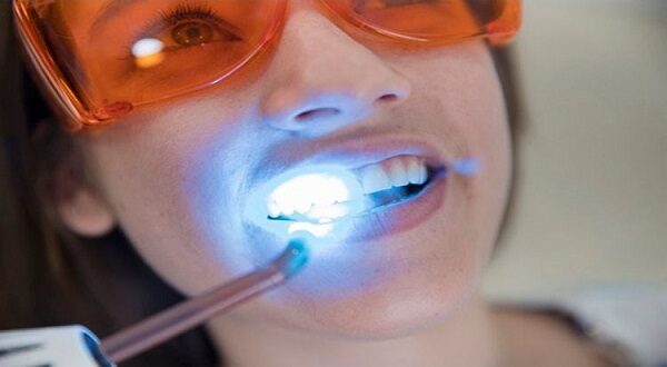 فوائداستخدام الليزر في طب الأسنان التجميلي 01155558285