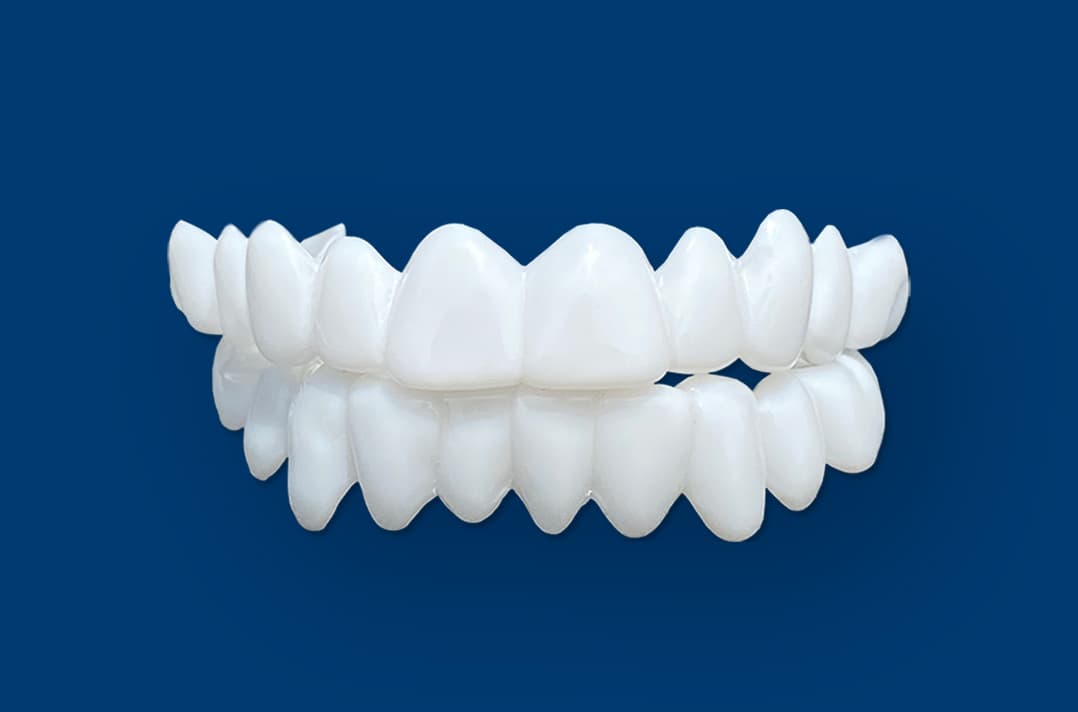 ابتسامة هوليود في المهندسين