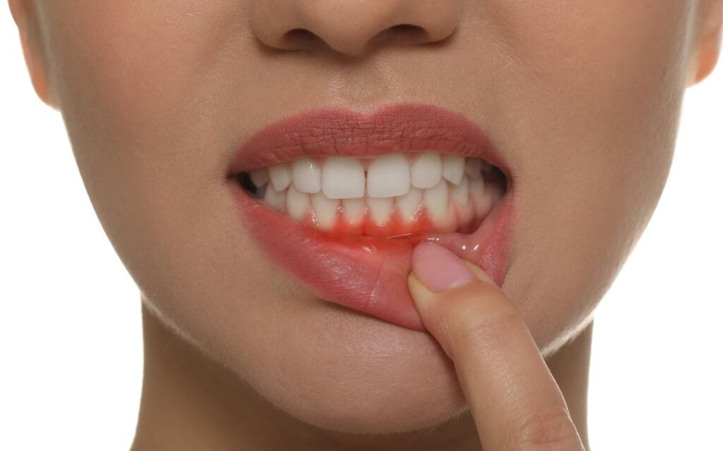 أسباب التهابات اللثه وكيفية علاجها