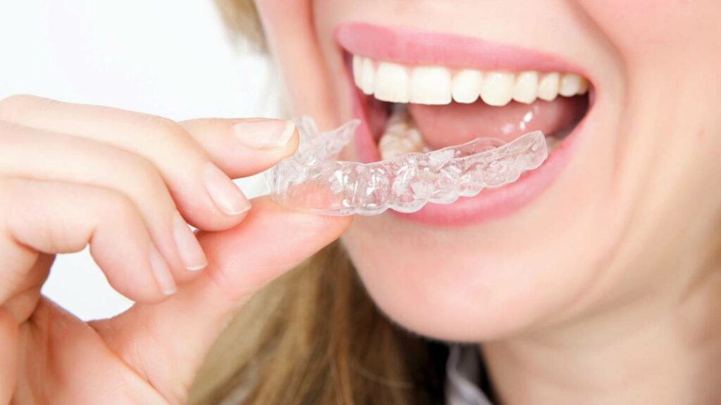 التقويم الشفاف: مميزاته وعيوبه ومين يناسبه؟ 1 التقويم الشفاف: مميزاته وعيوبه ومين يناسبه؟