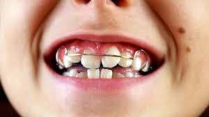 عيادة تقويم أسنان للاطفال