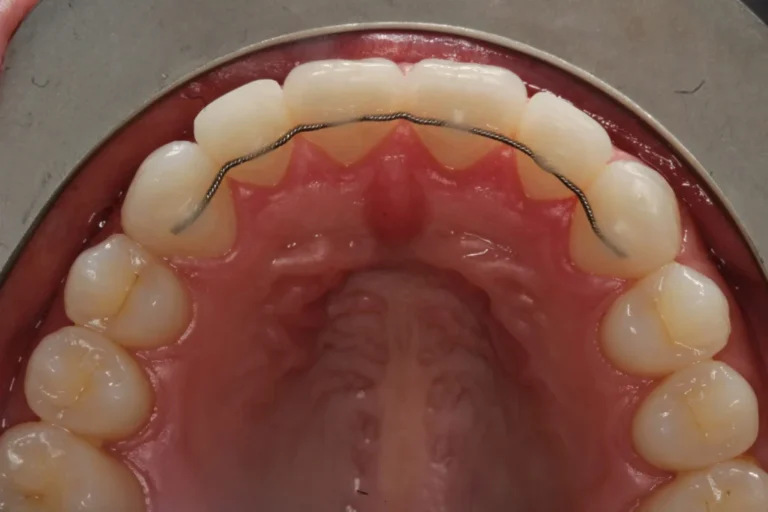 ألم التقويم أول أسبوع:إمتى تقلق؟