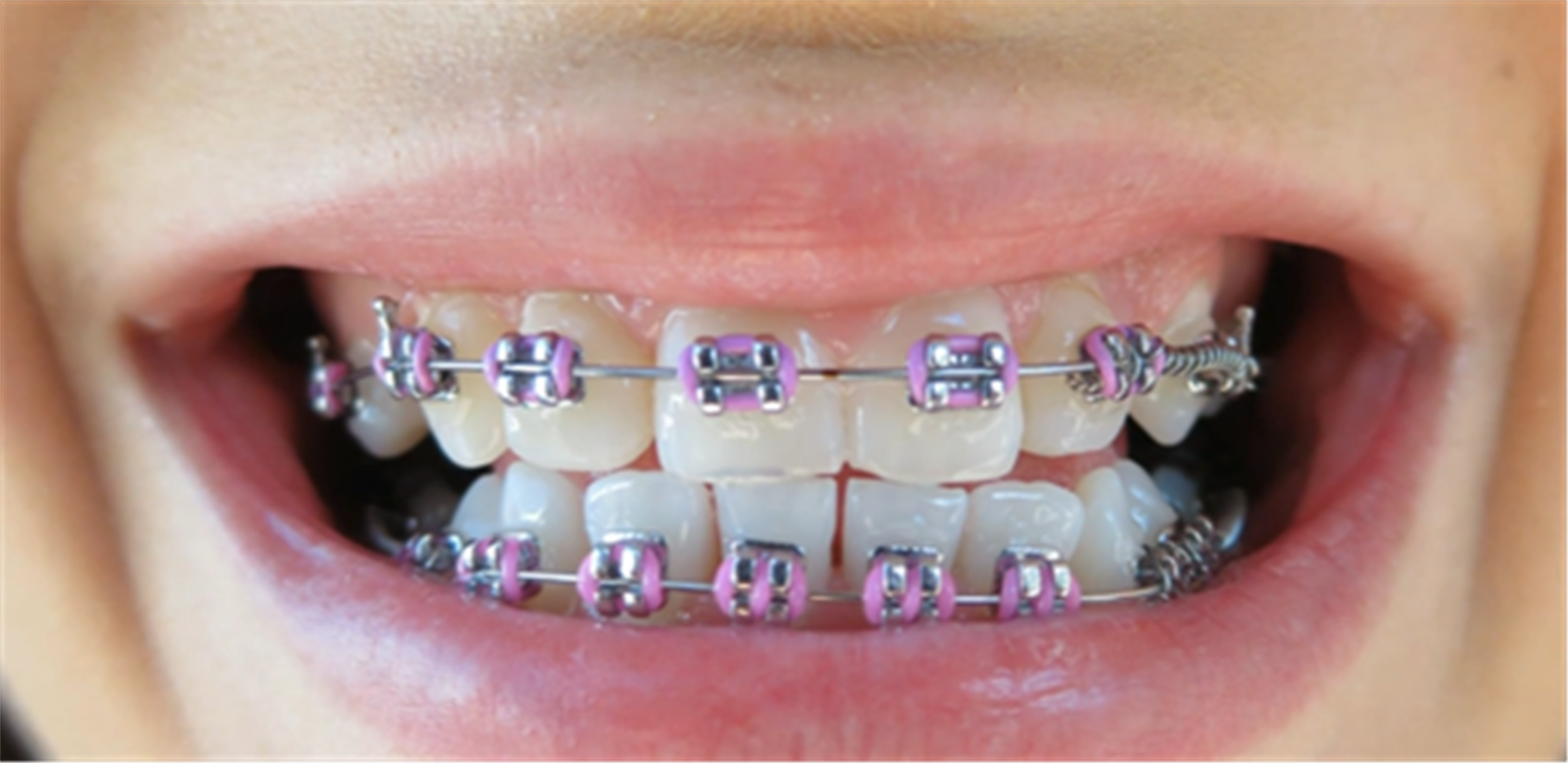 أجمل ألوان التقويم اختيار اللون المناسب حسب البشرة