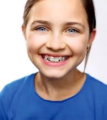 تقويم الأطفال المبكر