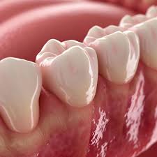 جيوب اللثة إيه هي؟ وإزاي تتعالج؟