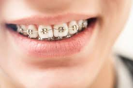 مدة التقويم: إيه اللي يخلي الحالة تطوّل أو تقصر؟