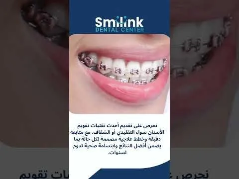 فيديو: افضل عيادة تقويم اسنان في المهندسين فيديو: افضل عيادة تقويم اسنان في المهندسين